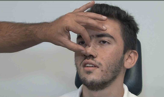 3 yaşında burnunda travma meydana geldi, 16 yıl sonra kıkırdak dokusunun yok olduğu anlaşıldı