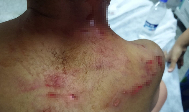 Köpeğin saldırısına uğrayan çocuğun kafasında derin yaralar oluştu