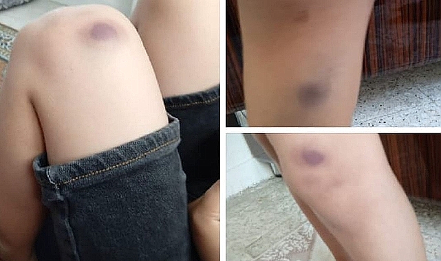Urfa'da bir öğrenci darp edildi