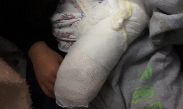 Kolu sağlam denilen çocuğun kolu başka bir hastanede kırık çıktı!