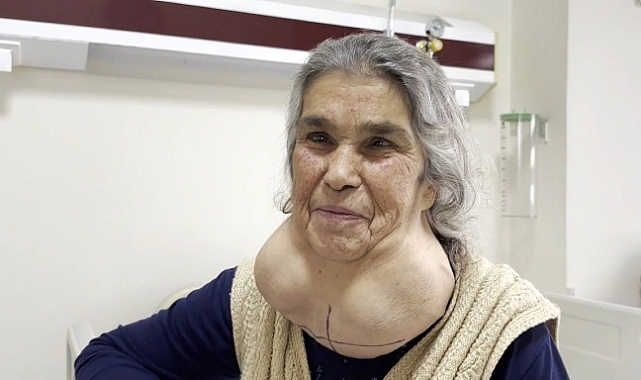 Doktordan korktuğu için yıllarca devasa kitleyle yaşadı