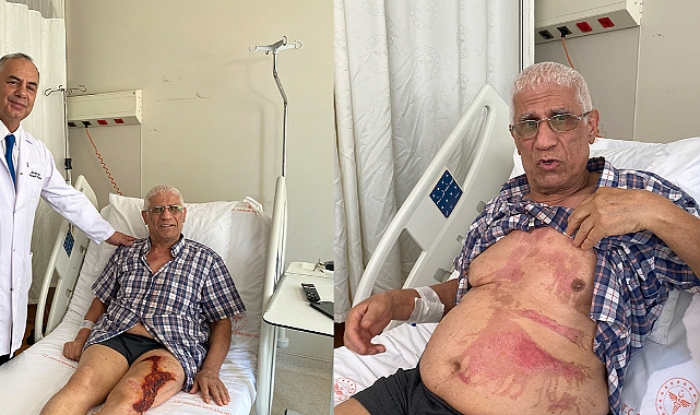 Doktor; omuz çıkığı için kendi ekipmanını tasarladı