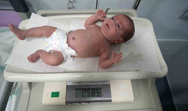 895 gram doğan Güneş bebek hayata tutundu