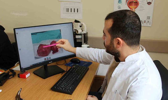 300 gramlık prostat dokusu başarıyla çıkarıldı