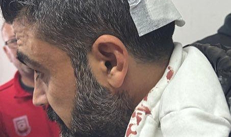 Urfa futboluna şiddetin gölgesi düştü