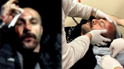 Barolardan şiddete tepki