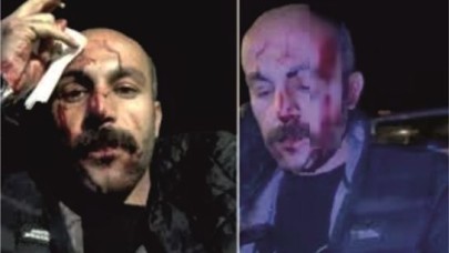 'Avukata şiddet' olayına açıklama