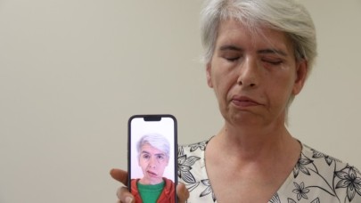 Sol gözünü 30 yıl sonra 24 ayar altınla yapılan tedavi sonucu kapattı