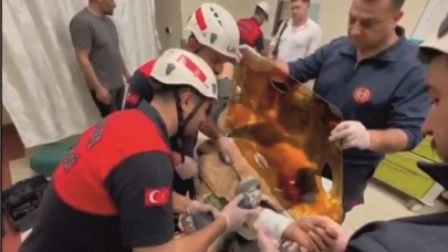 İşçinin imdadına itfaiye yetişti