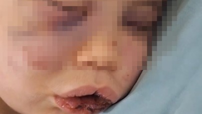 Denizli’de 2 Yaşındaki Bebek Şiddet Mağduru