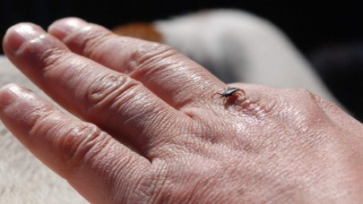 Uzmanlar; "Kene ısırığına dikkat"