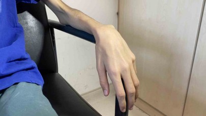 Ergenlerde anoreksiya tehlikesi: "Aileler, ‘Okuldan arandık, bayıldı’ diyor, sosyal hayatlarını devam ettiremiyorlar"