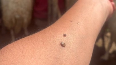 Uzmanından kene uyarısı; Kapalı giysileri tercih edin!