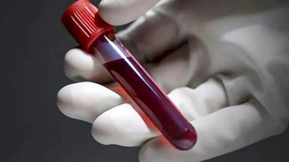 Eşi Benzeri Olmayan Kan Grubu