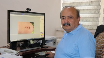 Sıcak hava keneleri harekete geçirdi: 1 kene, 10 bine yakın yumurta bırakabiliyor