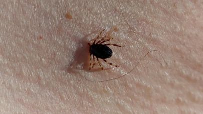 Prof. Dr. Gürdal Yılmaz: "Bu yıl 21 KKKA vakası geldi bu hastalardan ikisi hayatını kaybetti"