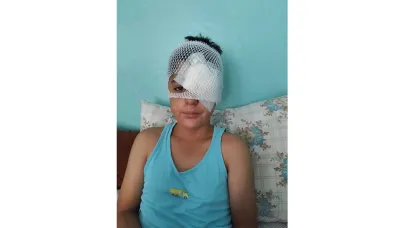 Şanlıurfa’da köpek saldırısından kaçan çocuğa otomobil çarptı