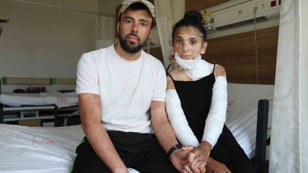 Azerbaycanlı çiftin doğal gaz patlamasında kapanan elleri, 3 yıl sonunda Eskişehir’deki tedaviyle kavuştu