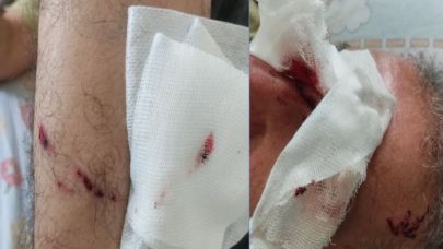 Şanlıurfa’da başıboş köpekler şehir sakinlerine saldırdı