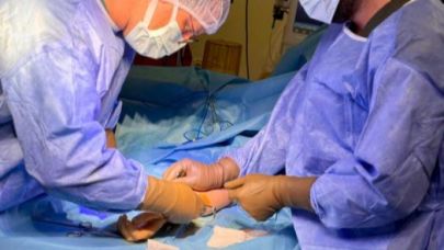 Hilvan Devlet Hastanesi'nde bir ilk