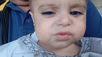 Görme engelli minik Umut için yardım bekleniyor (VİDEO)