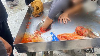 Kız çocuğu elini salça makinesine kaptırdı