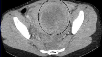 Şanlıurfalı kadınlar, bu haber sizi ilgilendiriyor