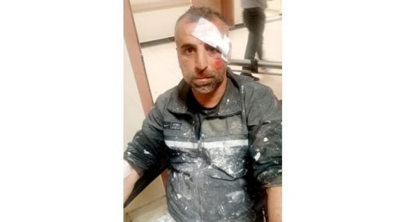 Sokak köpekleri iki kişiyi yaraladı