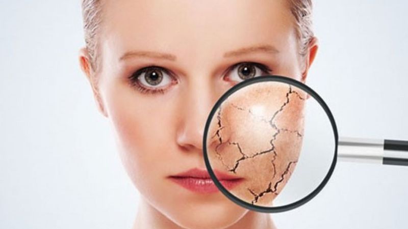 Hava sıcaklıkları artıyor, cilt kuruluğu olanlar nasıl önlemler almalı