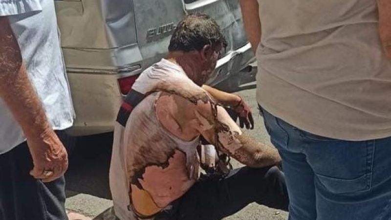 Aydınlatma panosunda patlama: 2 yaralı