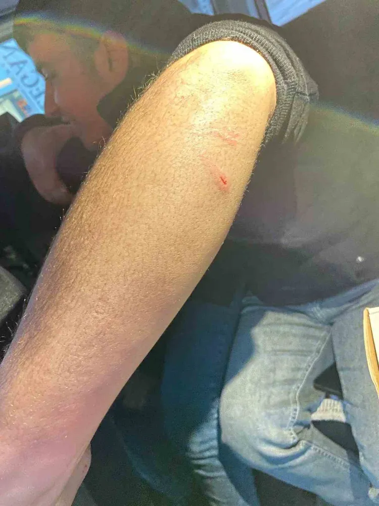 Oto sanayisinde sokak köpeklerinin saldırdığı genç yaralandı