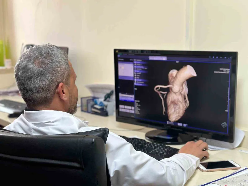 Kalp hastalıkları Kardiyak MR ile etkili ve hızlı teşhis ediliyor