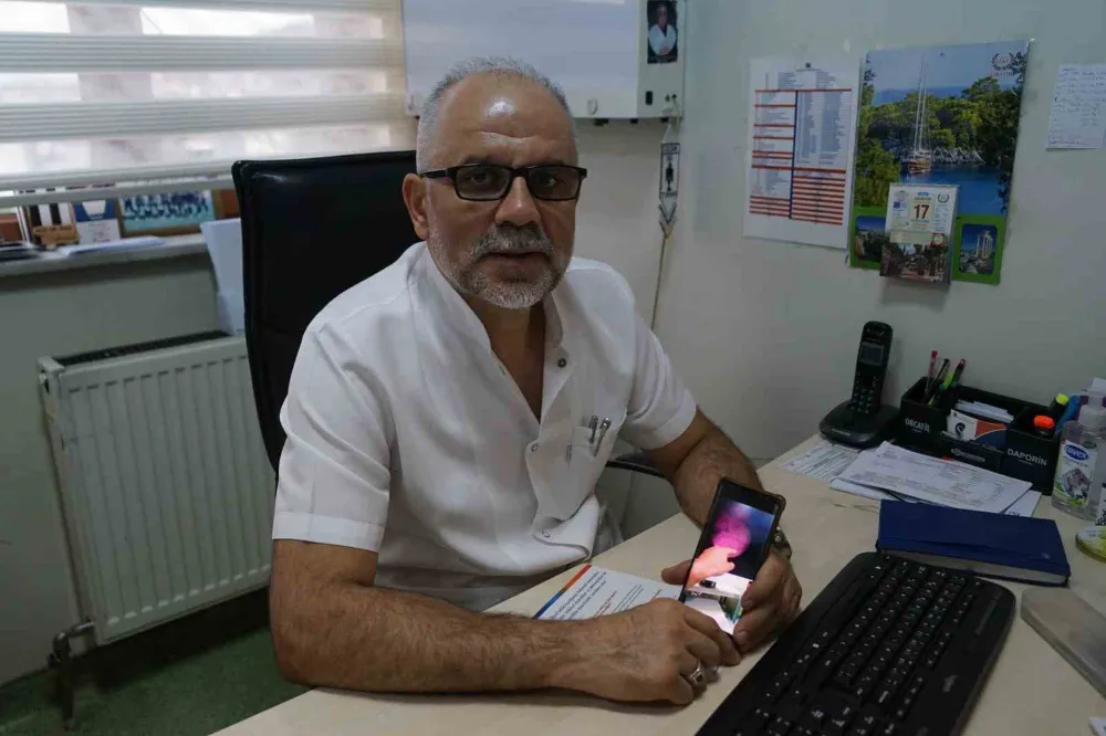 Prostat büyümesi için endoskopik rezum ameliyatı