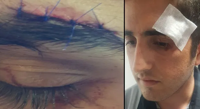Eyyübiye’de güvenlik görevlisi darp edildi iddiası