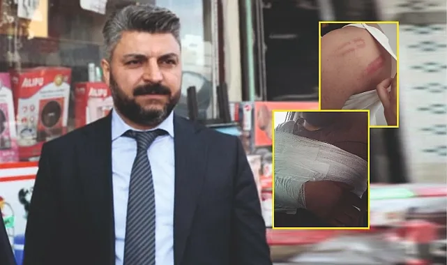 Samak neden serbest kaldı?