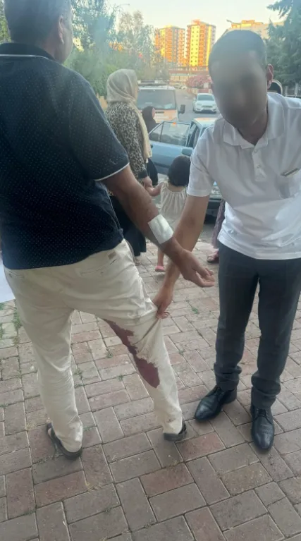Urfa’da başıboş köpek saldırısı!