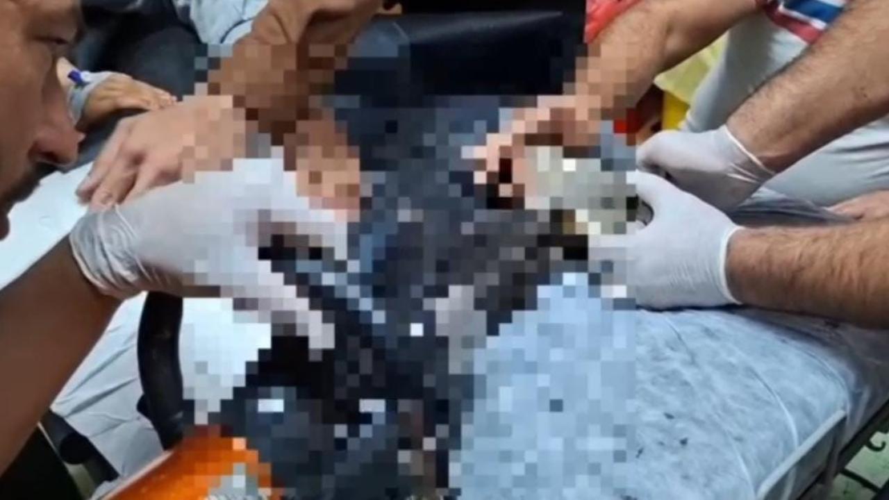 Elini kıyma makinesine kaptıran çocuk tedavi altına alındı