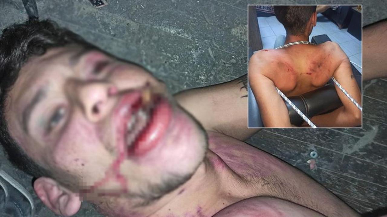 Şanlıurfalı gence işkence ettiler: 20 yıl hapisleri isteniyor