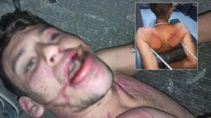 Şanlıurfalı gence işkence ettiler: 20 yıl hapisleri isteniyor