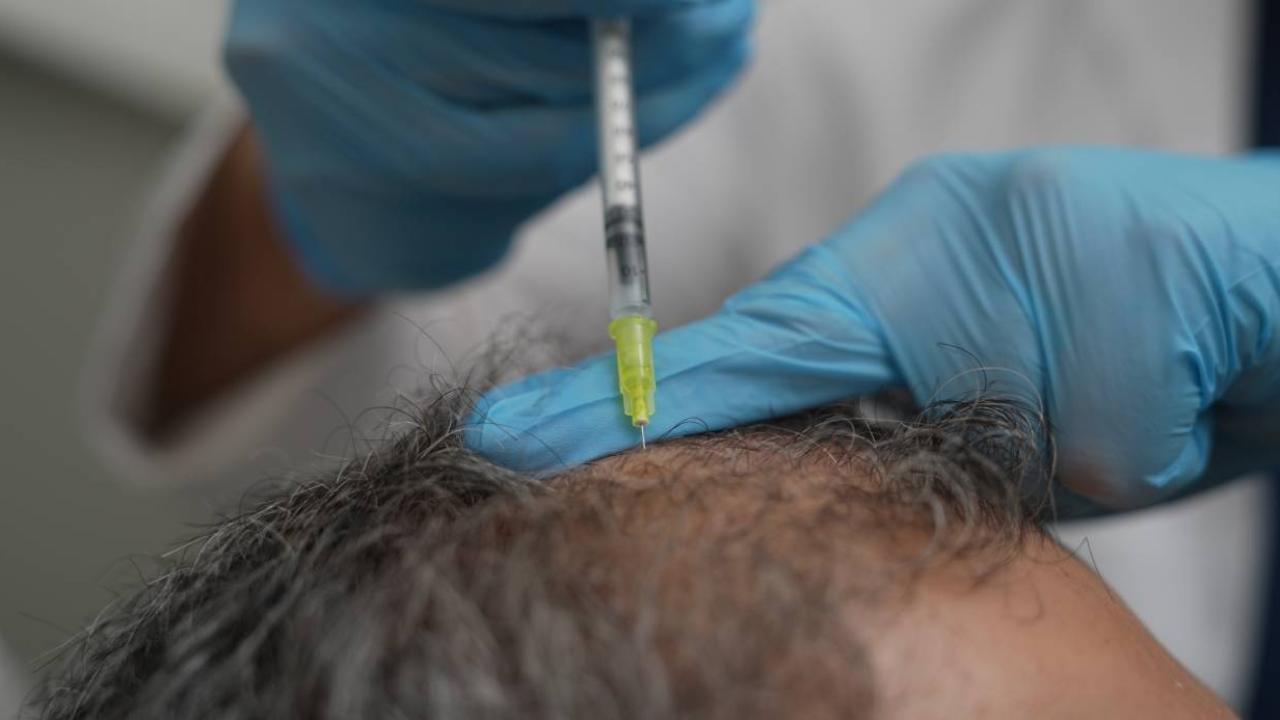 Dökülen saçlar vücudun bir alarmı olabilir