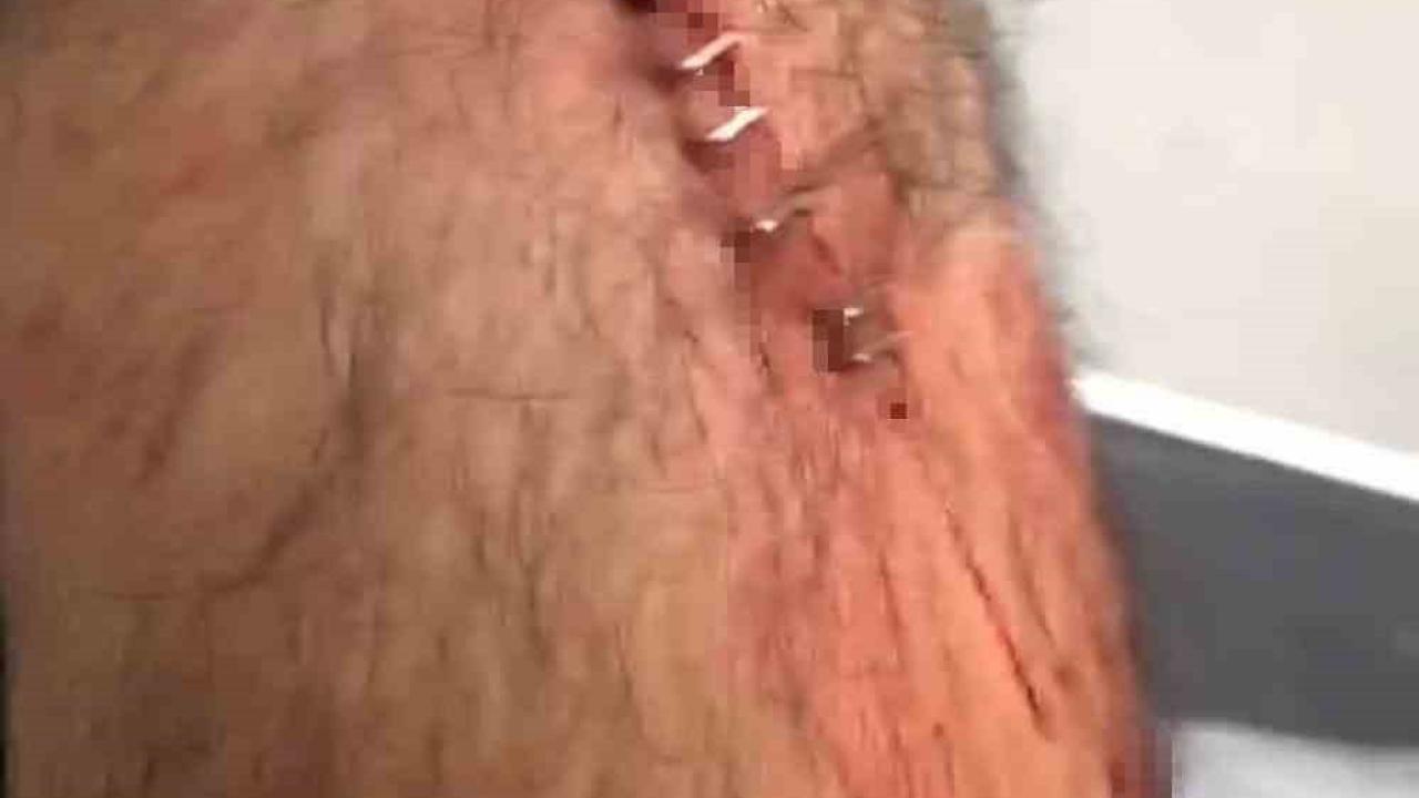 Şanlıurfa’da görev yapan öğretmene sokak ortasında jiletli saldırı