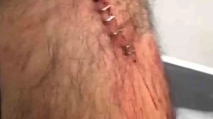 Şanlıurfa’da görev yapan öğretmene sokak ortasında jiletli saldırı