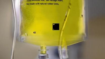 Şanlıurfa’da sarı serum alarmı