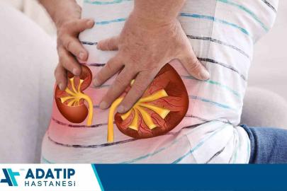 Böbrek taşı vakalarında kişiye özel tedavi