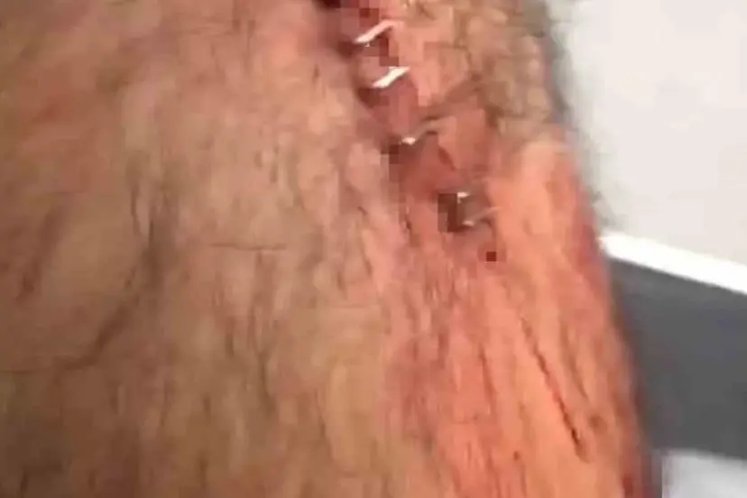 Şanlıurfa’da öğretmene sokak ortasında jiletli saldırı